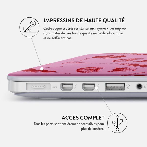 Burga Coque Rigide Apple MacBook Pro 14 pouces (2021 / 2023 M3 chip / 2024 M4 chip / 2025 M5 chip) - Call me